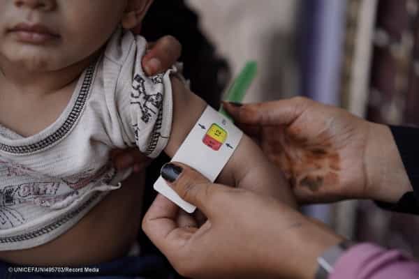 اليمن: مساهمة ألمانية بقيمة مليوني دولار لدعم خدمات الرعاية الصحية والتغذية
