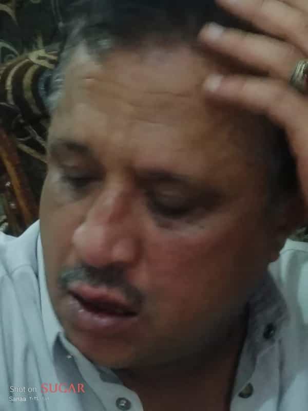 اليمن: نقابة الصحفيين تدين الاعتداء على الصمدي واستمرار ترهيبه