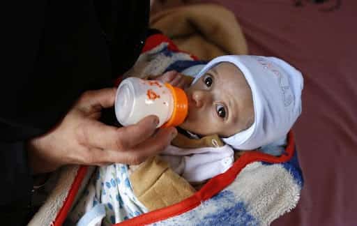 رويترز: 7.6 مليون يمني بحاجة للعلاج من سوء التغذية