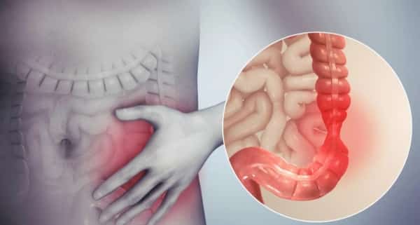 صحة: ما هو الرابط بين القولون العصبي والقلق؟