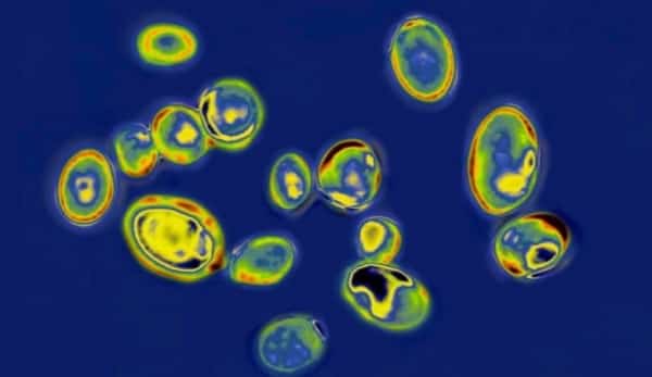 صحة: كيف تسببت عدوى فطرية قاتلة في مخاوف واسعة في الولايات المتحدة؟