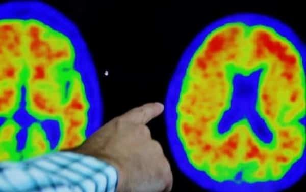 صحة: علماء يكشفون 5 أمور للحفاظ على الصحة العقلية