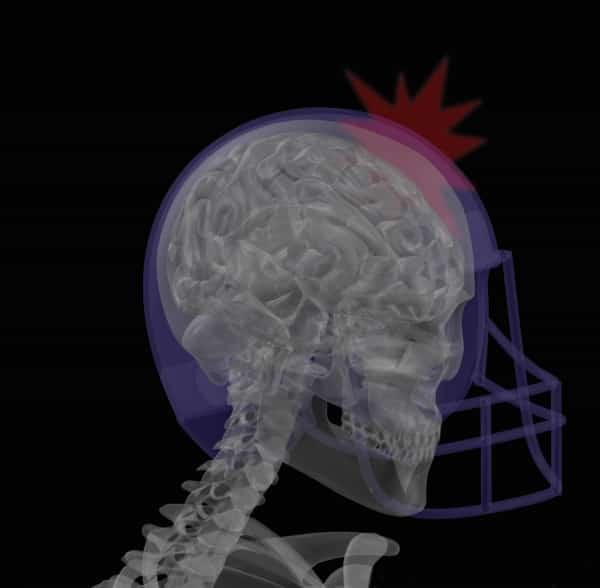 صحة: علماء توصلوا لتحديد علامات ارتجاج الدماغ من ميكروبيوم الأمعاء
