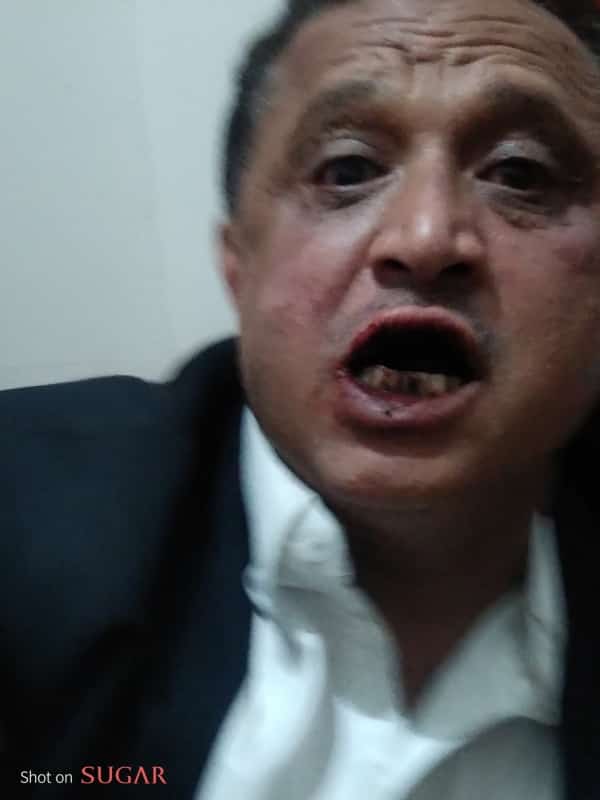 بروكسل: الاتحاد الدولي للصحفيين يدين الاعتداء على مجلي الصمدي ويطالب بتقديم الجناة للعدالة