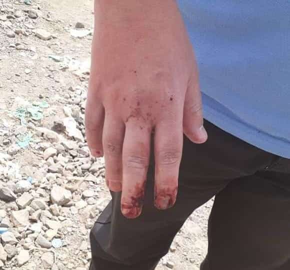 اليمن: "ميون" تدين الاعتداء على الدكتور الكبسي من قبل جماعة مسلحة في العاصمة صنعاء