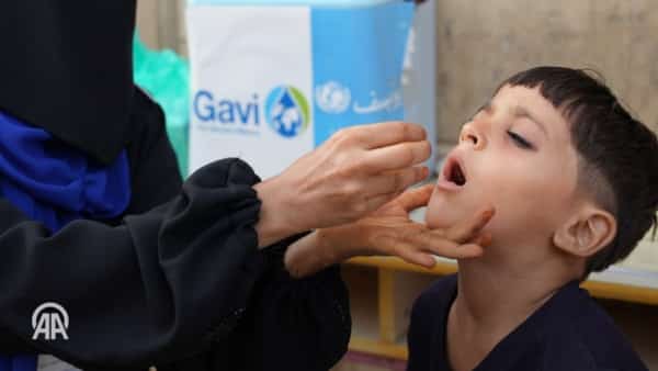 اليمن: أكثر من 42 ألف حالة إصابة بالحصبة بين الأطفال منذ مطلع العام الجاري