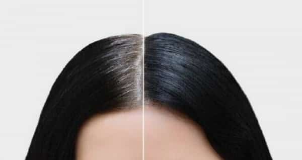 صحة: الشيب المبكر قد يمثل علامة للإصابة بأمراض محددة