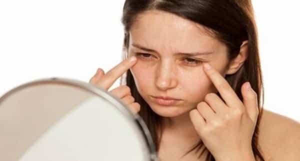 صحة: أسباب الهالات السوداء تحت العينين وعلاجها