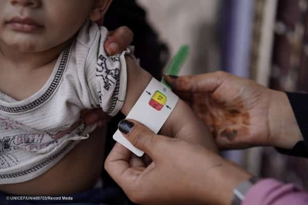 اليمن: مساهمة ألمانية بقيمة مليوني دولار لدعم خدمات الرعاية الصحية والتغذية