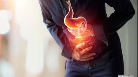 صحة: كيف يمكن التخلص من حرقة المعدة؟