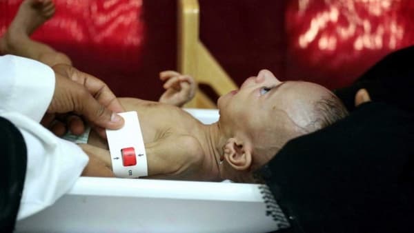 بكاء الاطفال من اجل الطعام الذي لا يأتي