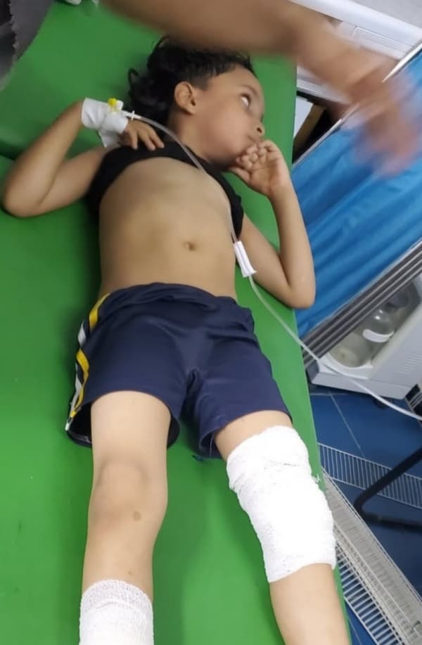 إصابة 12 طفلا بقصف حوثي في تعز غداة مساع اممية مكثفة لتمديد الهدنة
