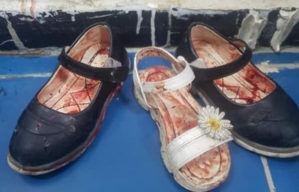 أنباء عن وفاة أحد الأطفال الضحايا للقصف الحوثي على حي الروضة بتعز