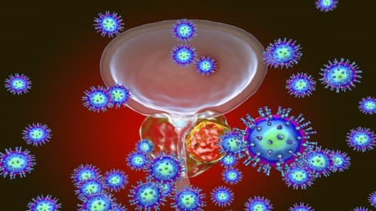 لماذا علامات سرطان البروستات المبكرة ليست واضحة؟
