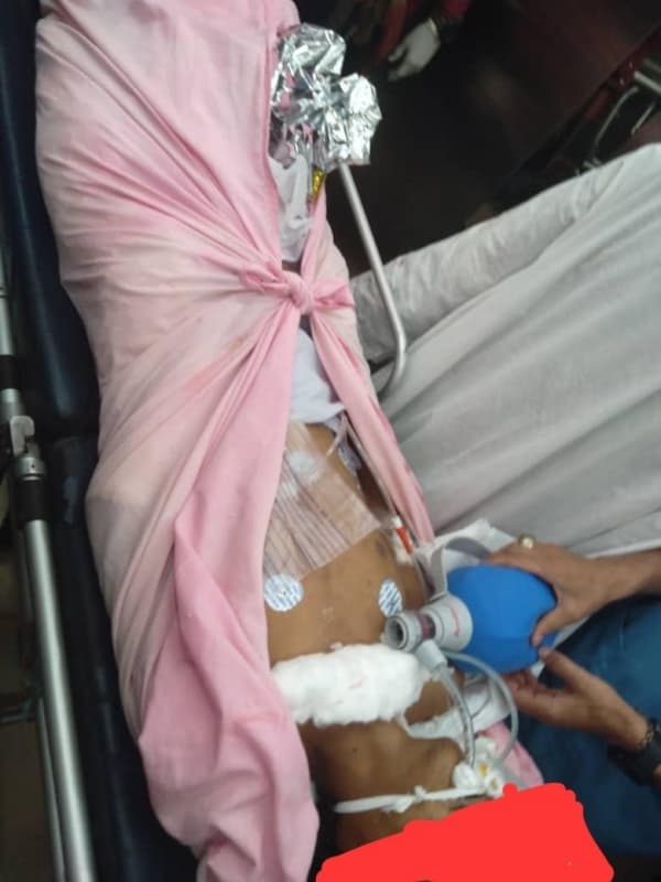 مقتل طفل وإصابة آخر بانفجار لغم في الحديدة