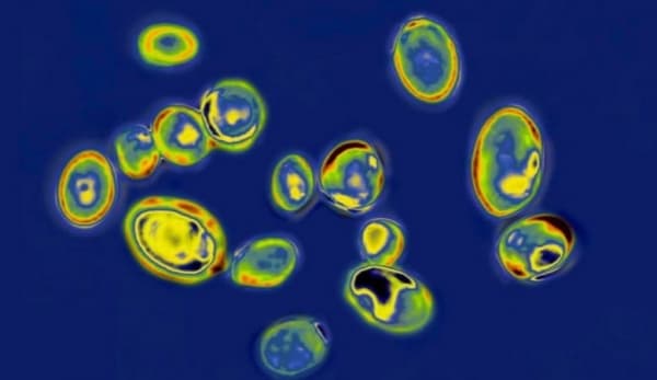 كيف تسببت عدوى فطرية قاتلة في مخاوف واسعة في الولايات المتحدة؟