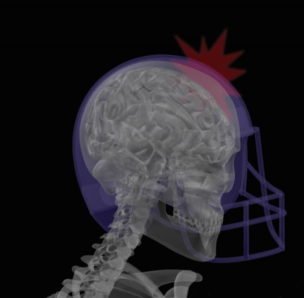 علماء توصلوا لتحديد علامات ارتجاج الدماغ من ميكروبيوم الأمعاء