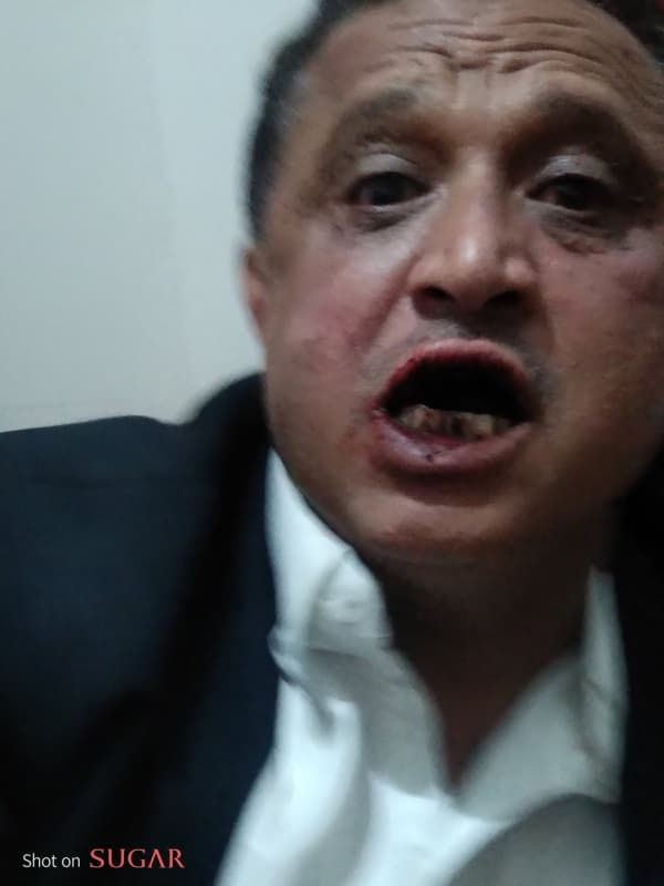 الاتحاد الدولي للصحفيين يدين الاعتداء على مجلي الصمدي ويطالب بتقديم الجناة للعدالة