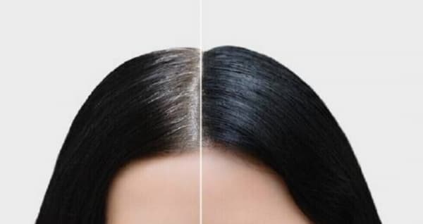 الشيب المبكر قد يمثل علامة للإصابة بأمراض محددة