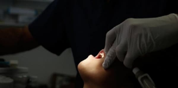 ماذا يحدث للأسنان مع التقدم في السن؟