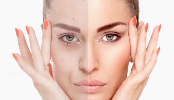 فيتامينات قد يسبب نقصها ‫جفاف البشرة