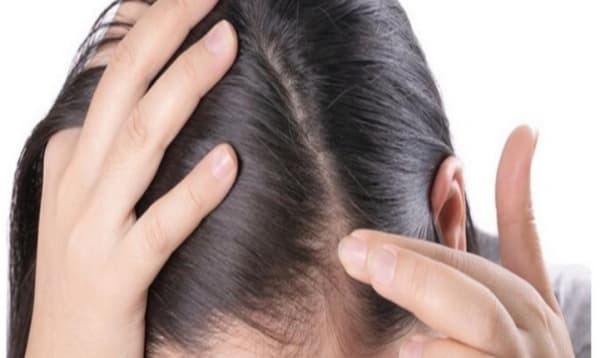 كيف تعزز نمو الشعر الصحي؟