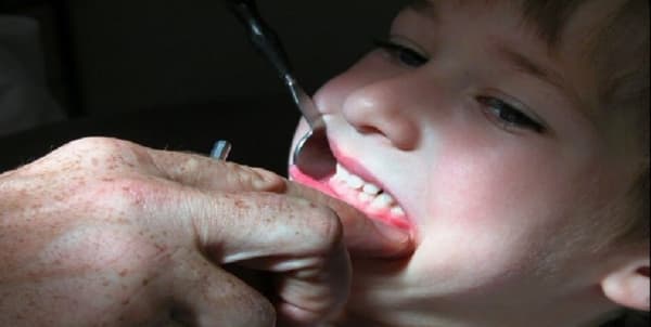 أمراض خطيرة تسببها مشكلات في الأسنان