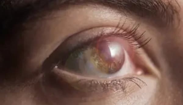 لتحسين البصر.. 5 تغييرات بسيطة في نمط الحياة