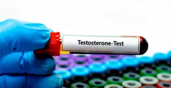 علامات نقص هرمون التستوستيرون لدى الرجال