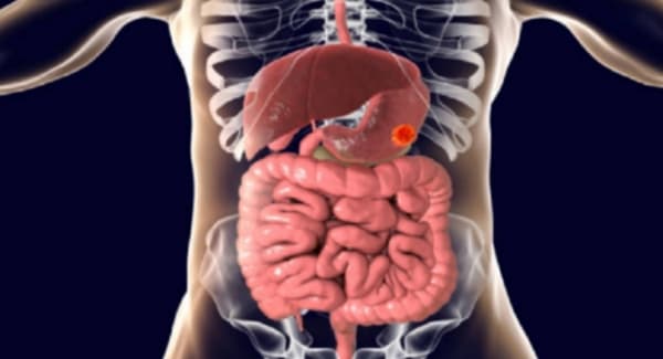 علامات قد تشير إلى سرطان المعدة
