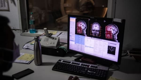 دراسة تكشف الأثر الذي خلّفته جائحة كورونا على أدمغة المراهقين