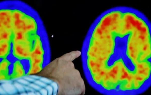 علماء يكشفون 5 أمور للحفاظ على الصحة العقلية