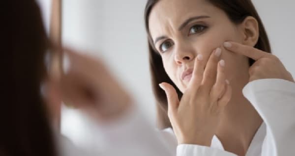 متى تشير البثور الهرمونية إلى الإصابة بمتلازمة تكيس المبايض؟