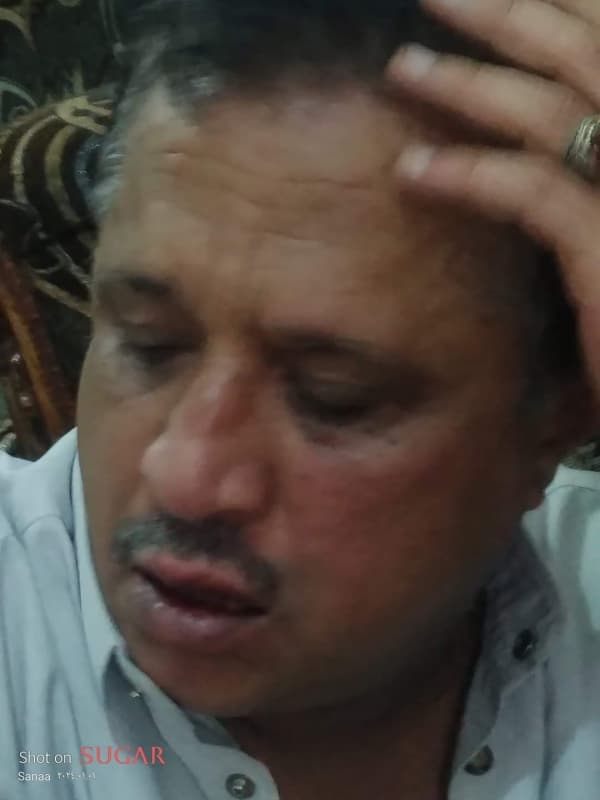 نقابة الصحفيين تدين الاعتداء على الصمدي واستمرار ترهيبه