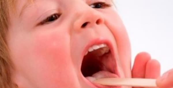 أبرز أسباب تورم الحلق عند الأطفال.. من العدوى إلى الجفاف