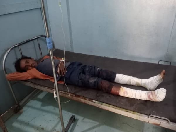 إصابة طفل بمقذوف منسوب للحوثيين في جنوب الحديدة